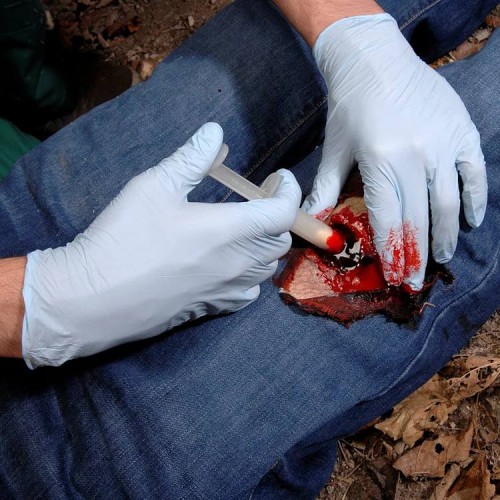 Аппликатор гемостатический с гранулами Rhino Rescue в Краснодаре хитозановый